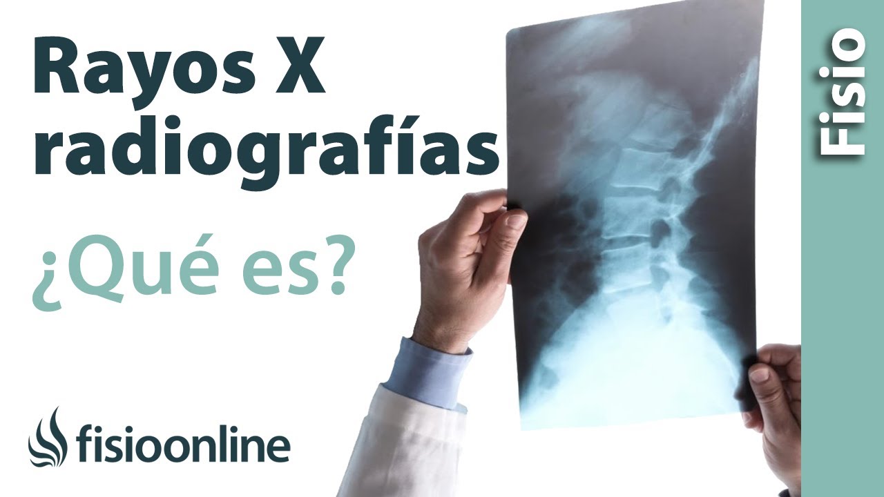 que significa rx en medicina