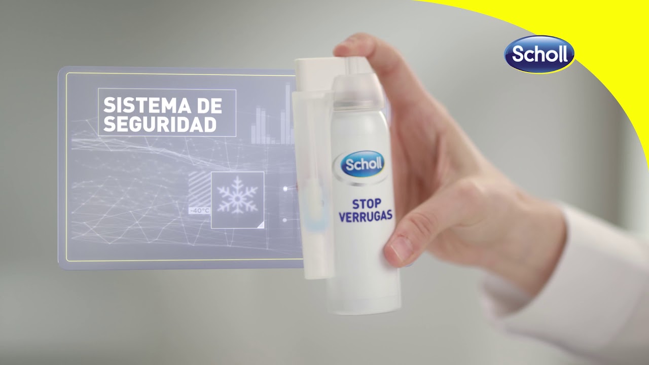 papiloma en el pie como quitarlo