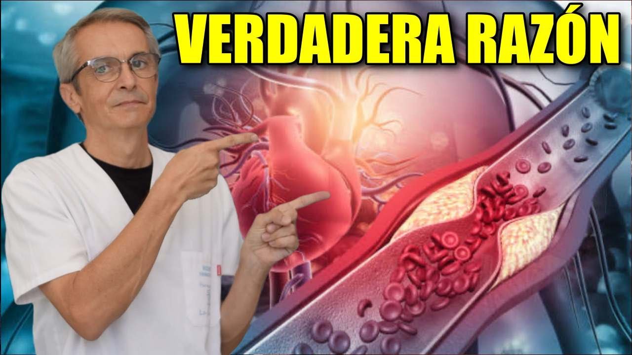 como eliminar las calcificaciones en las arterias