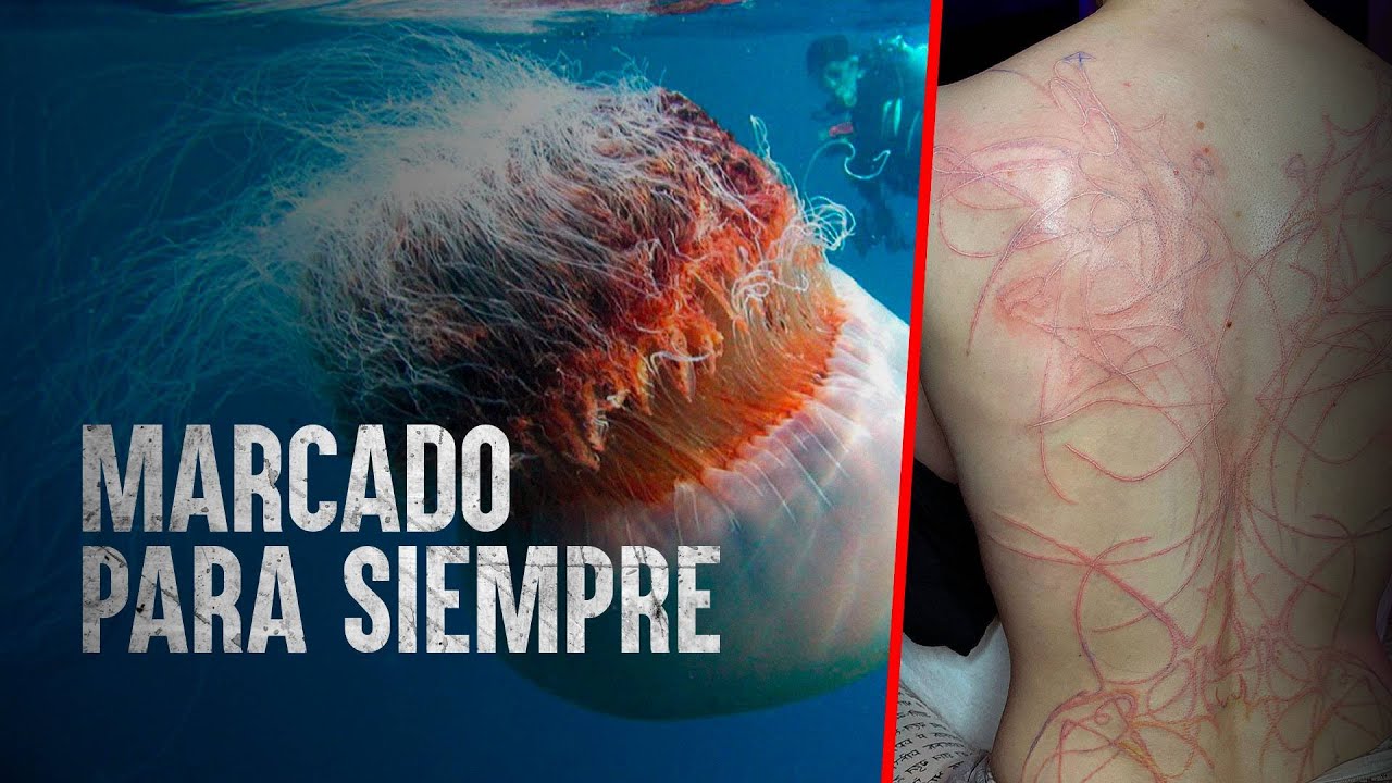 cuál es la medusa más peligrosa del mundo