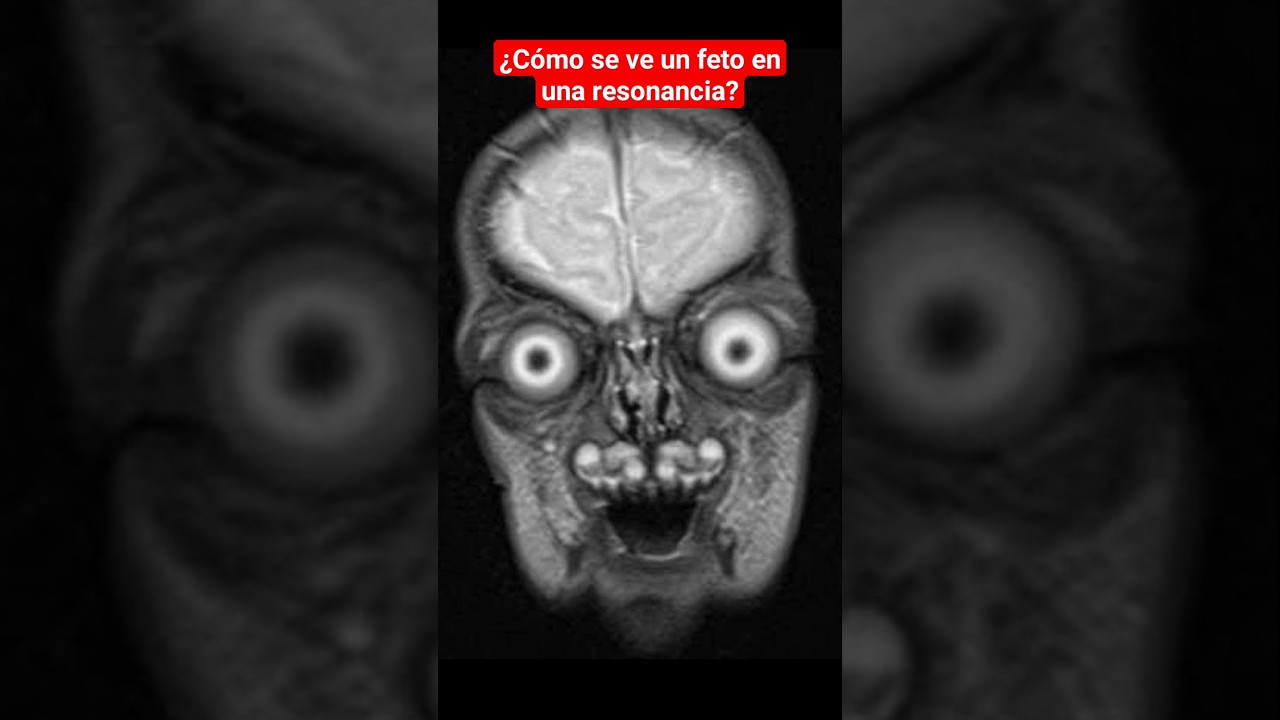 se ve un bebe en una radiografia