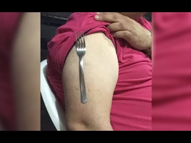porque se pegan los metales al cuerpo