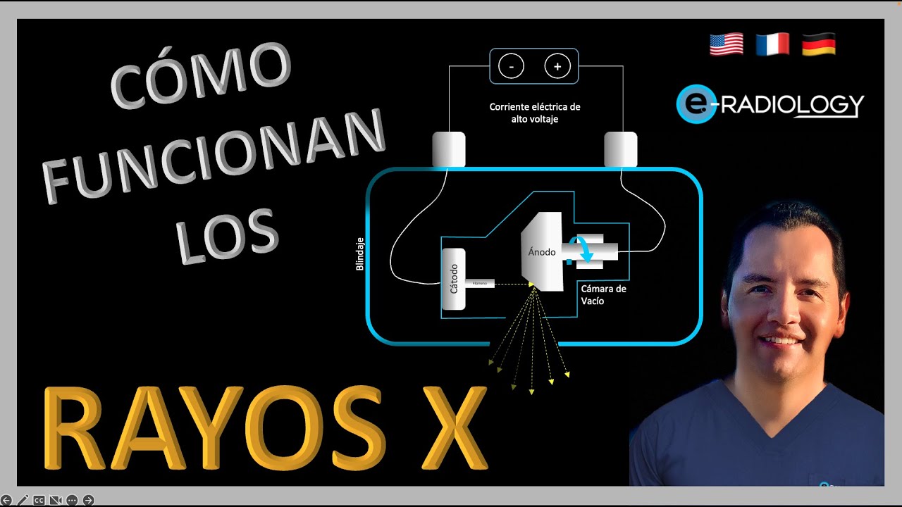 partes del aparato de rayos x