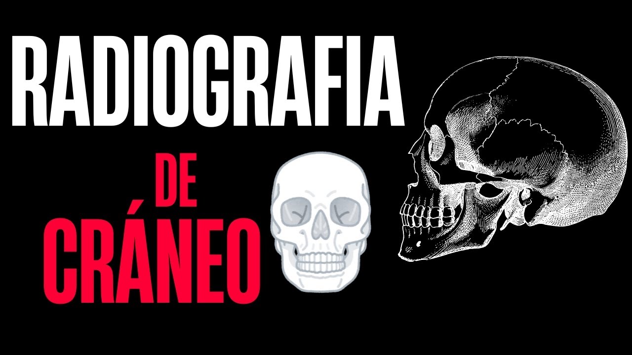 tipos de radiografias de craneo